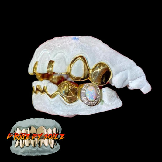 custom grillz