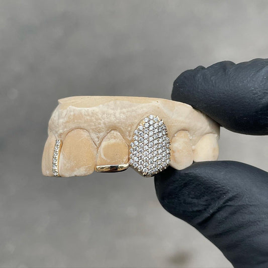 custom diamond tooth with spacer